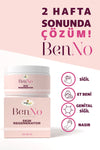 BenNo krem ile düzenli kullanımda 2 hafta sonunda siğil ve nasır görünümünde azalma