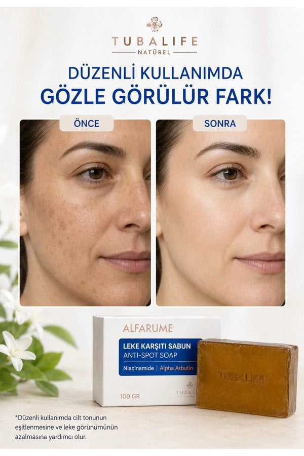 Alfarume Leke Karşıtı, Cilt Tonu Eşitleyici ve Aydınlatıcı Sabun – 100 gr